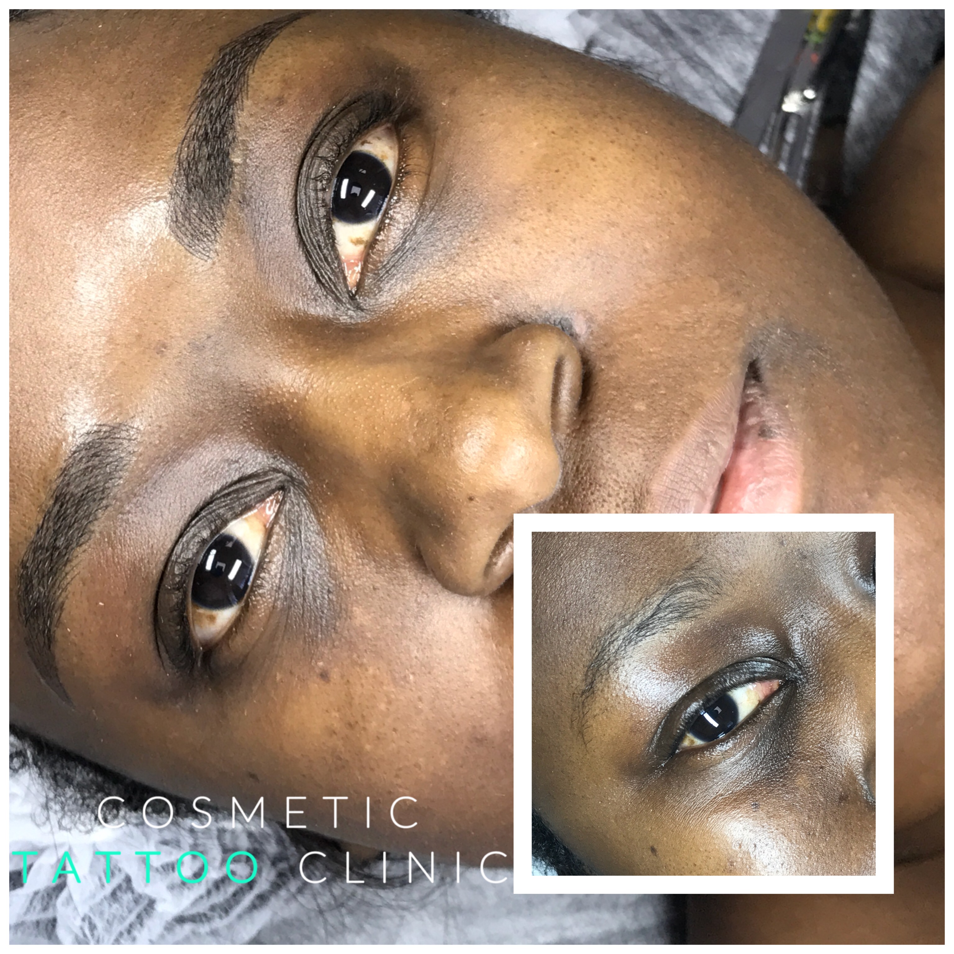 PhiBrows A close-up of young black woman before and after her Eyebrow procedure.