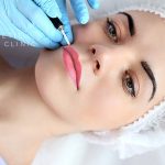 Profile of female undergoing Lip Tattooing.