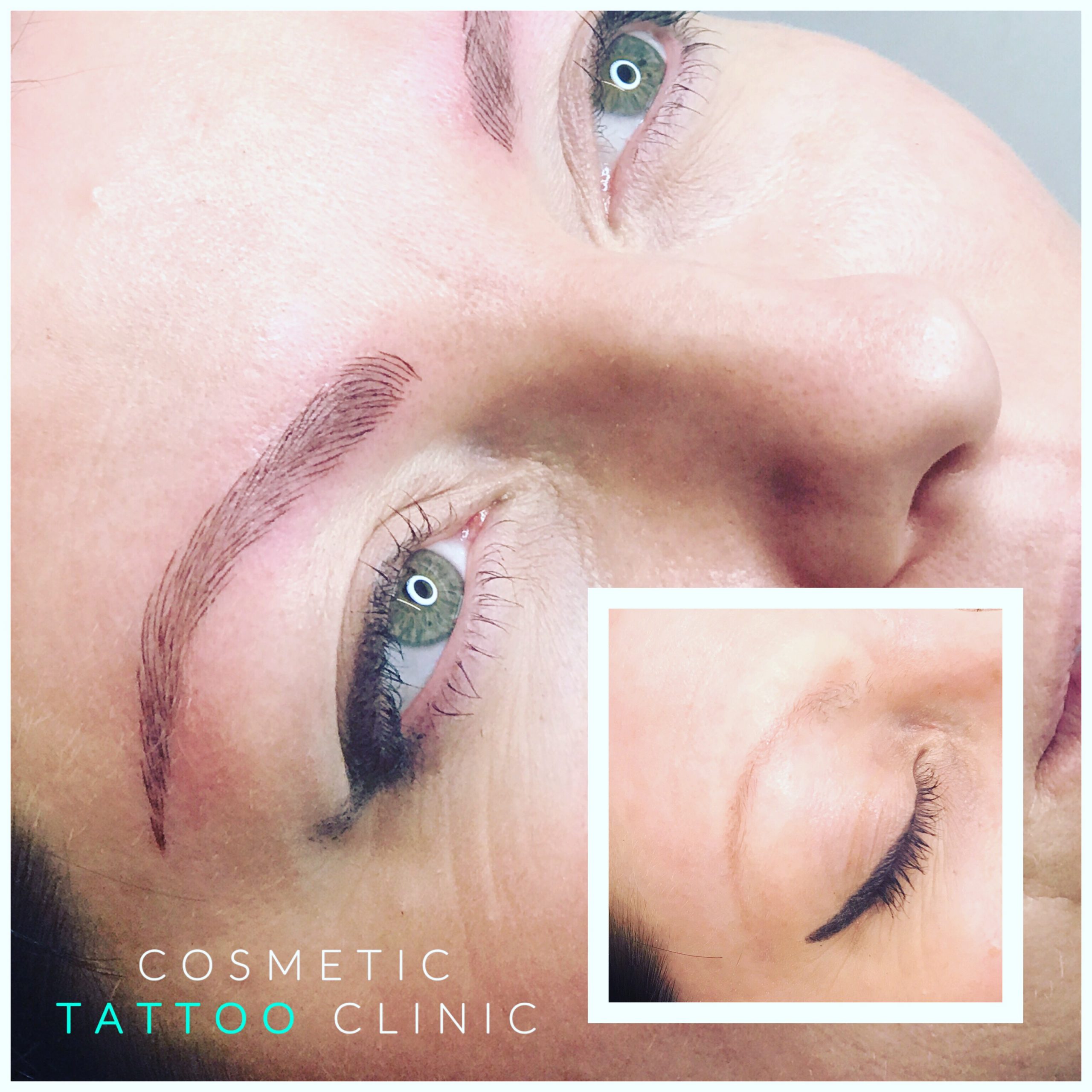 Microblading