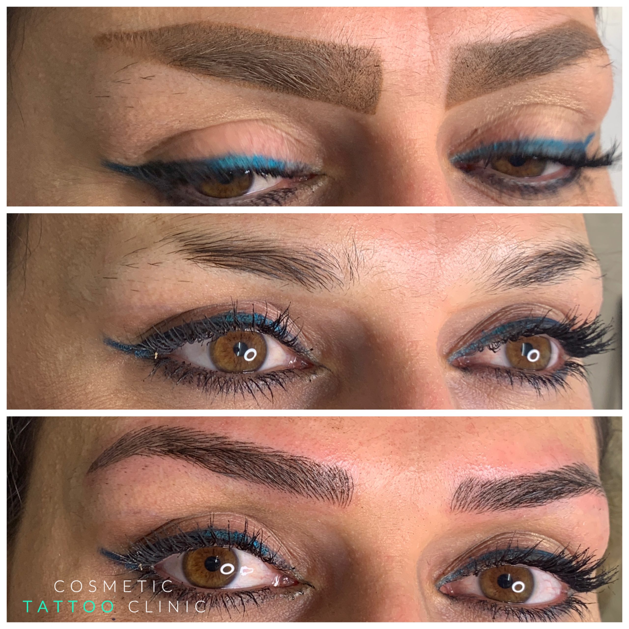 Microblading