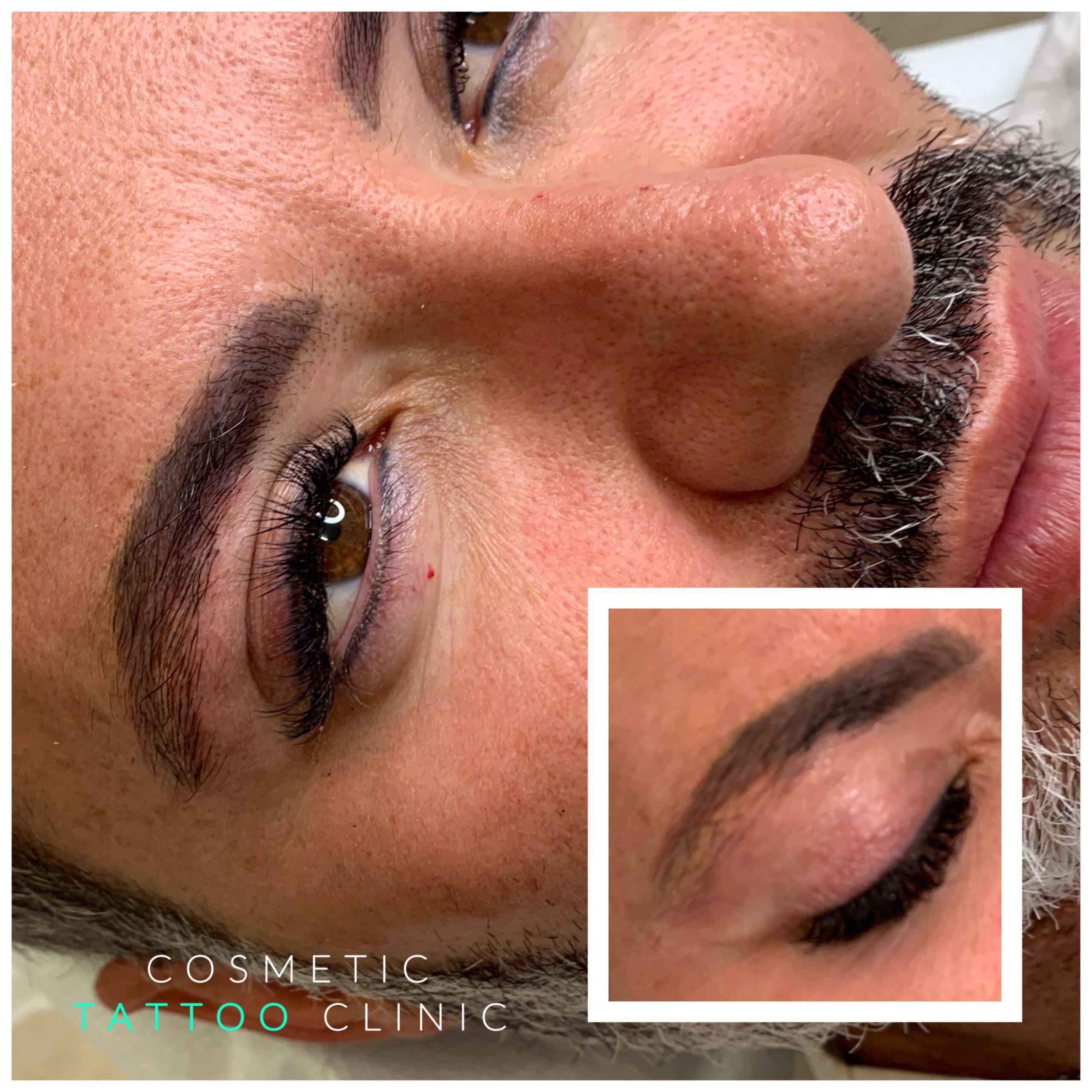 Microblading for men