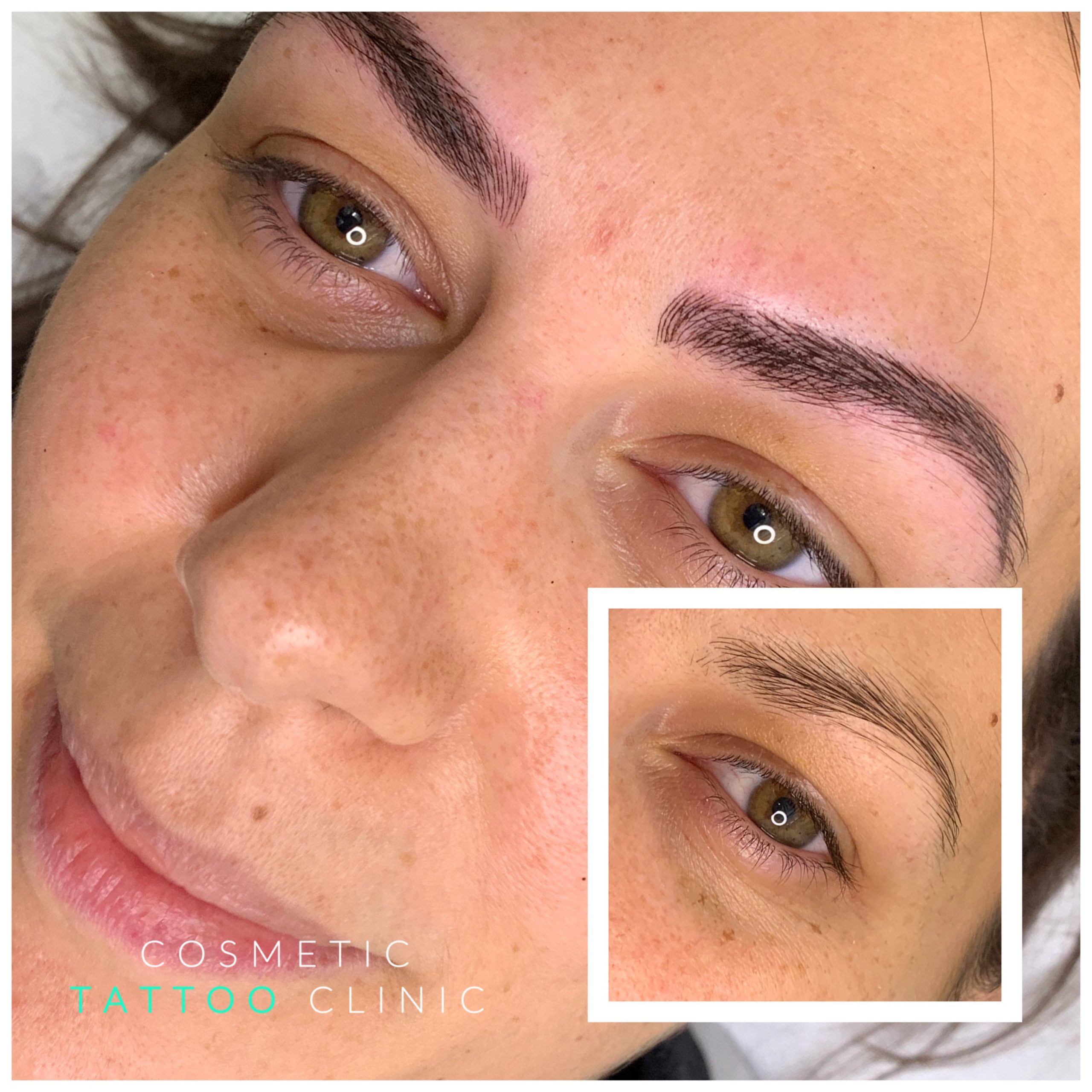 Microblading