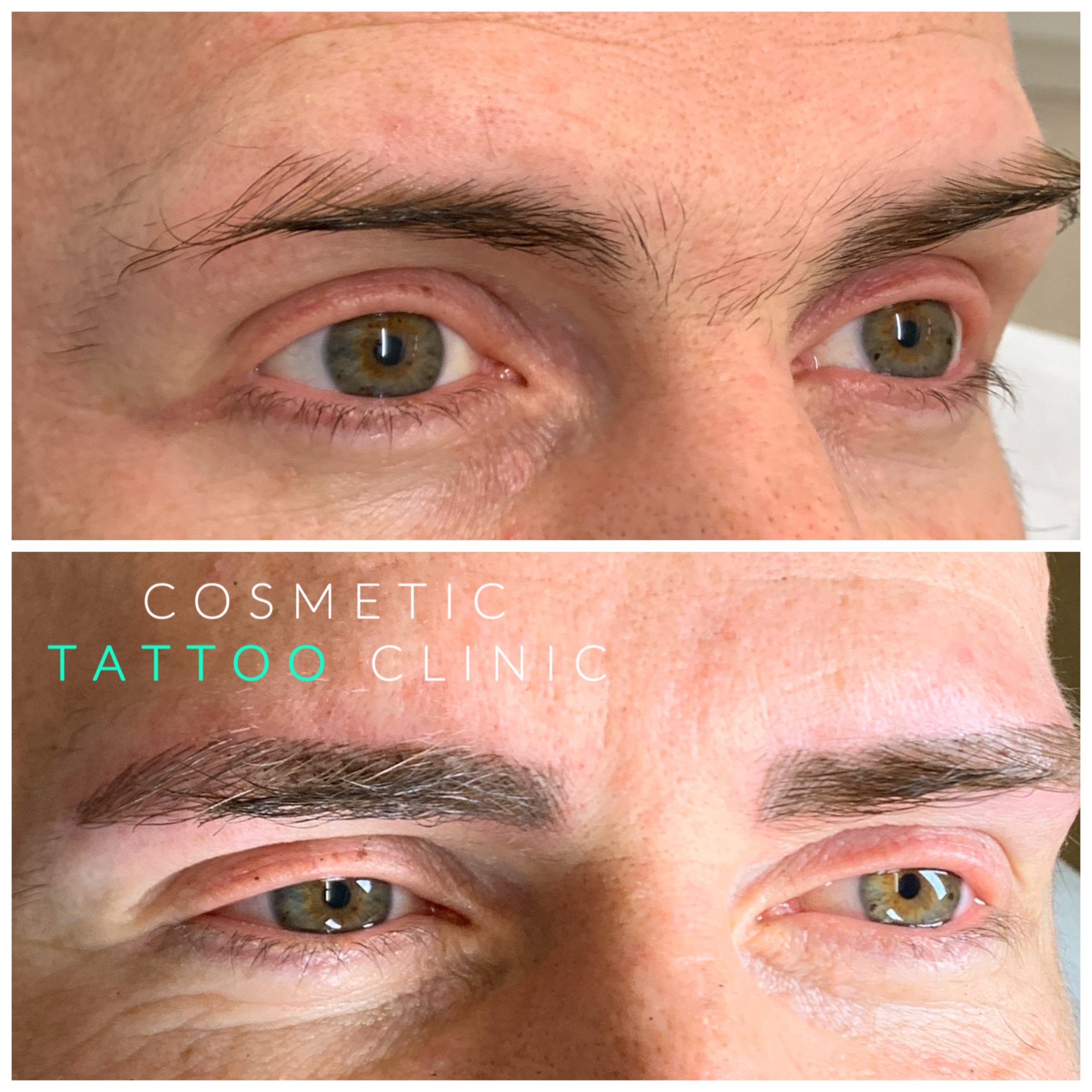 Microblading for men