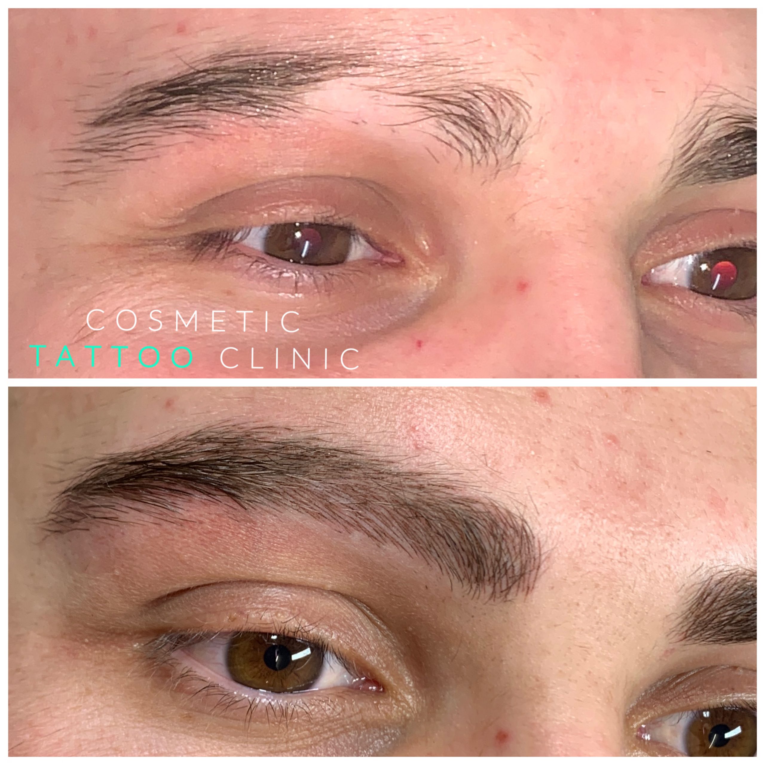 Microblading for men