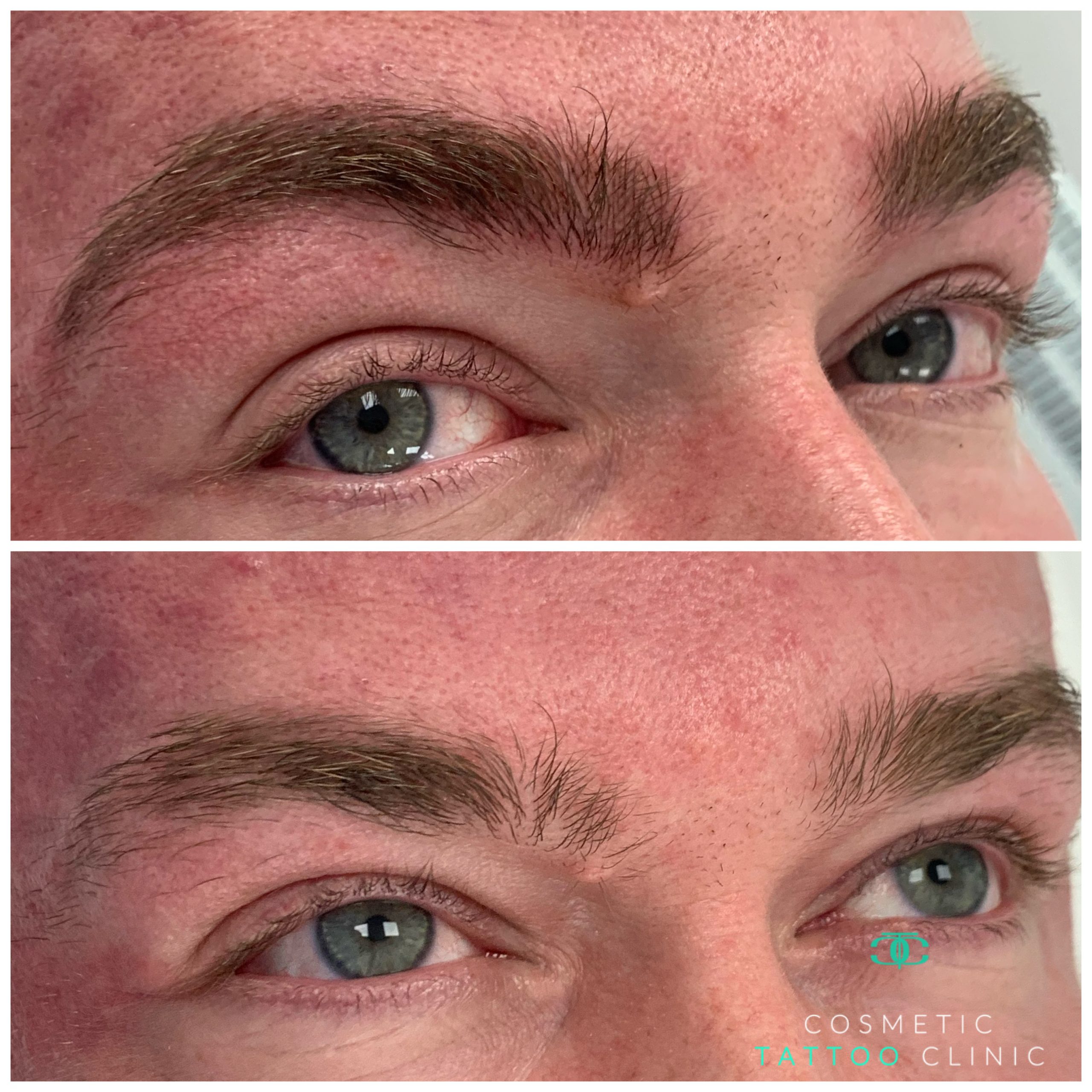 MIcroblading for men