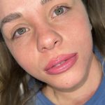 Lip tattooing on a young female demonstrating SPMU For All Generations.