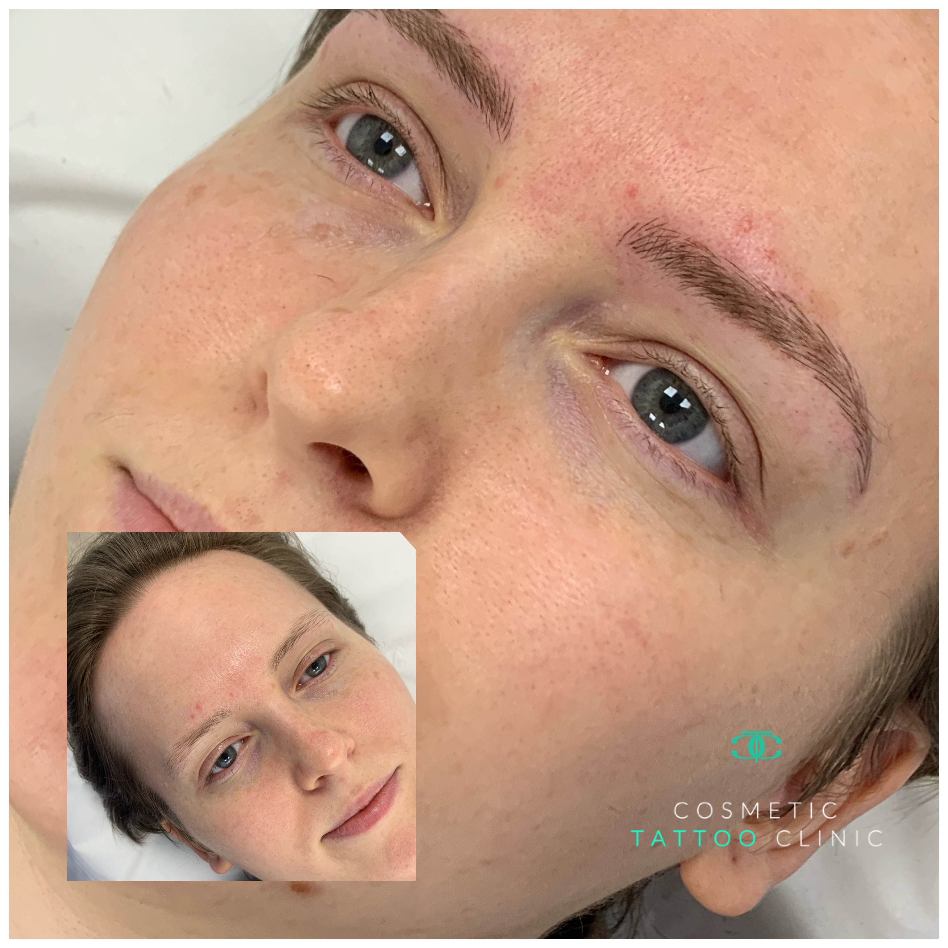 Microblading