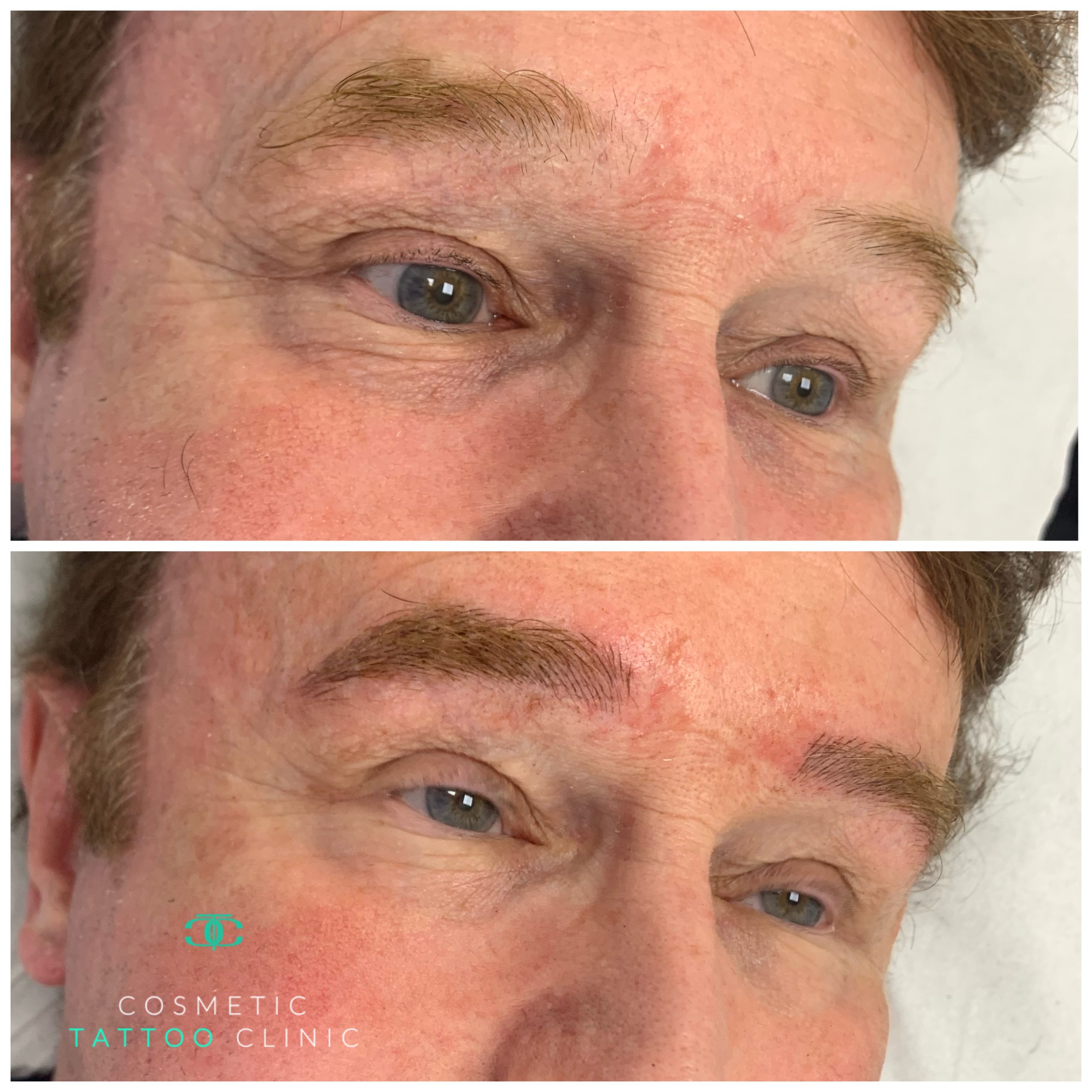 Microblading for Men