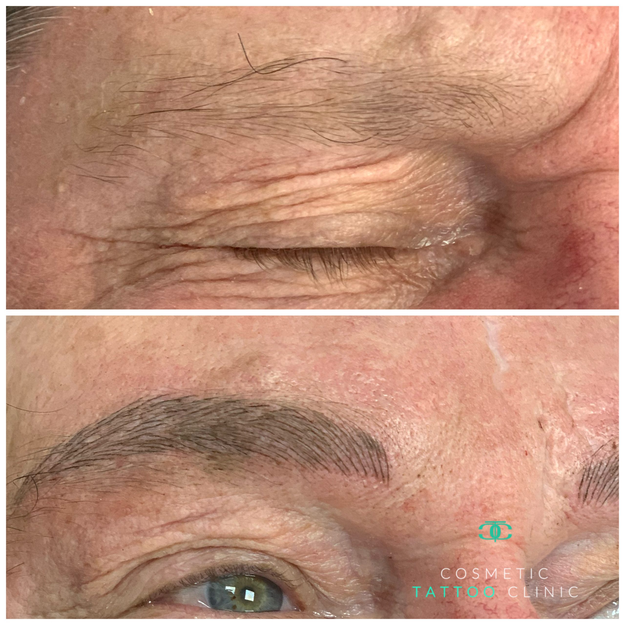 Microblading for Men