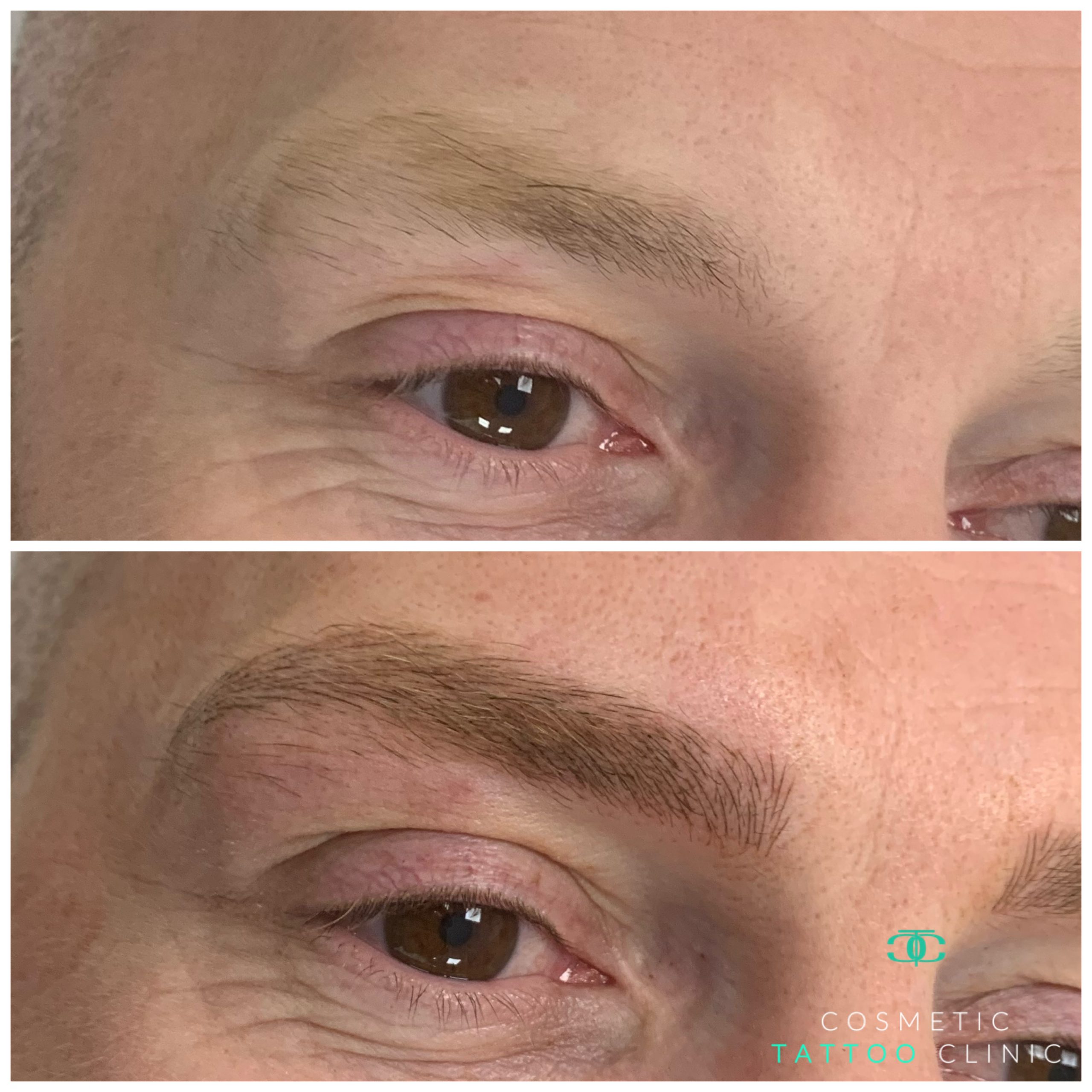 Microblading for Men