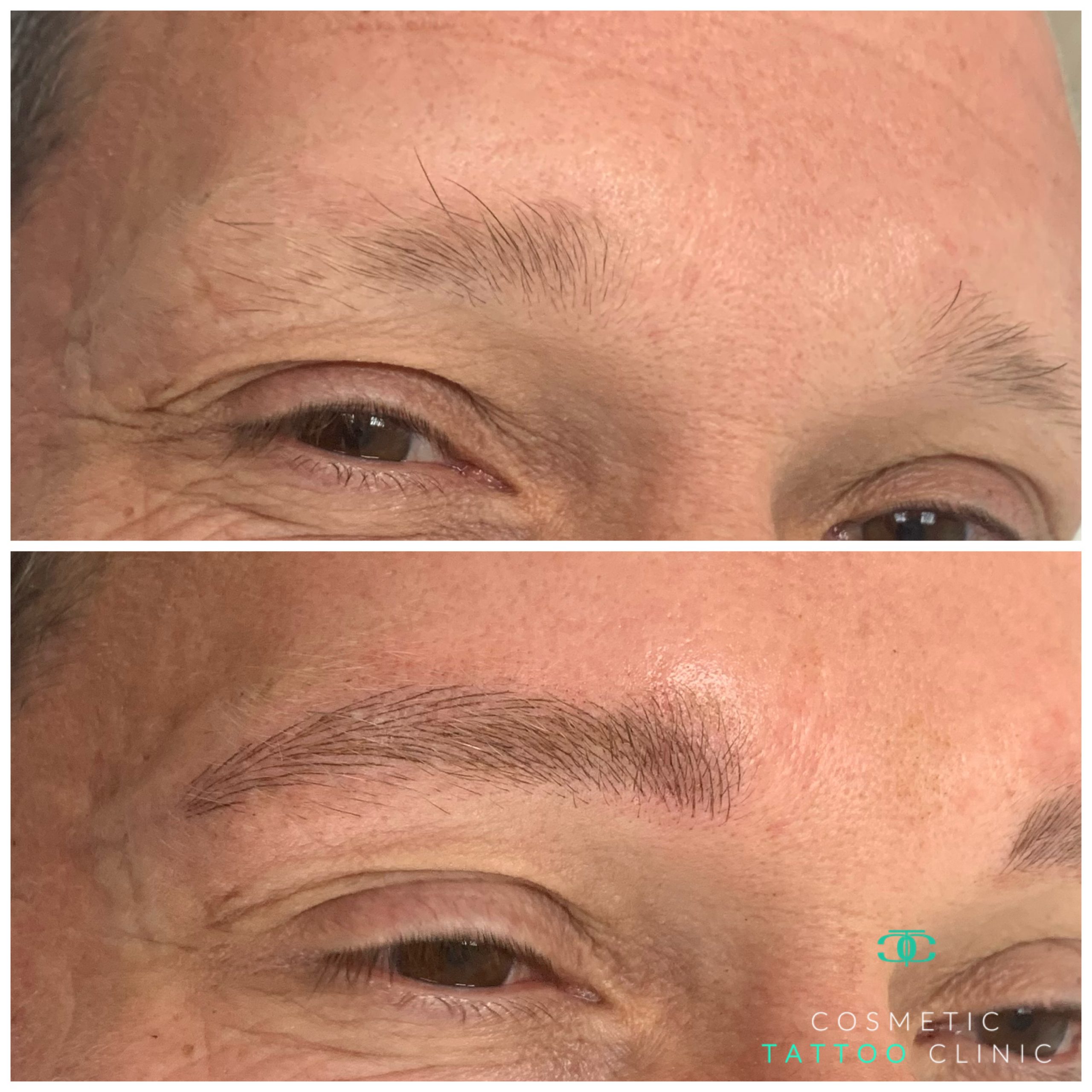 Microblading for Men