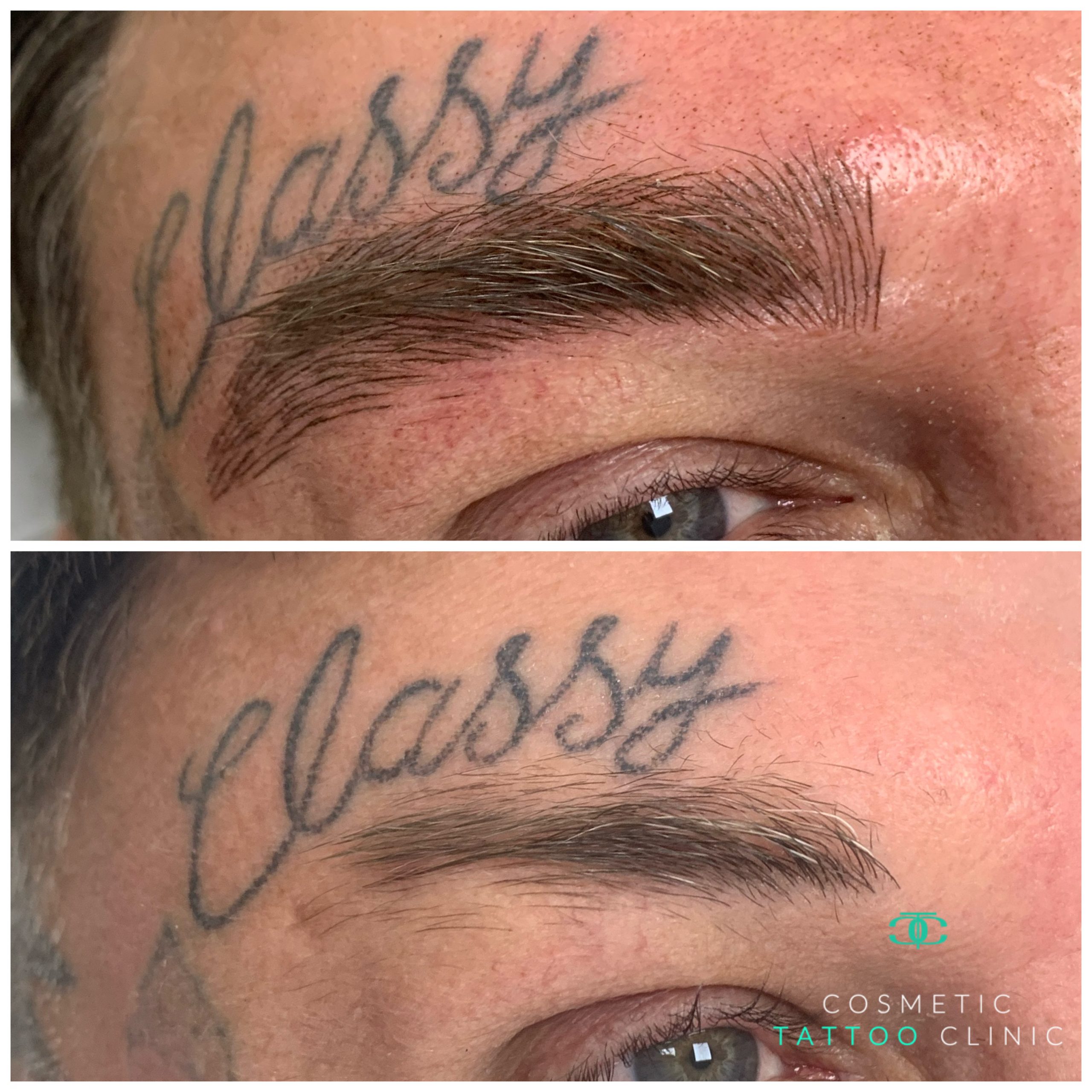 Microblading for Men