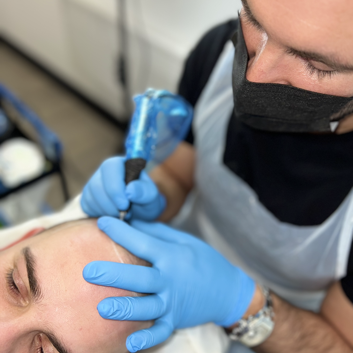 Scalp Micropigmentation