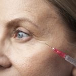Close-up of a woman having a hyaluronic acid injection.