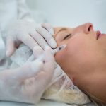 Close-up of female patient receiving an injectable Skin Booster on face.