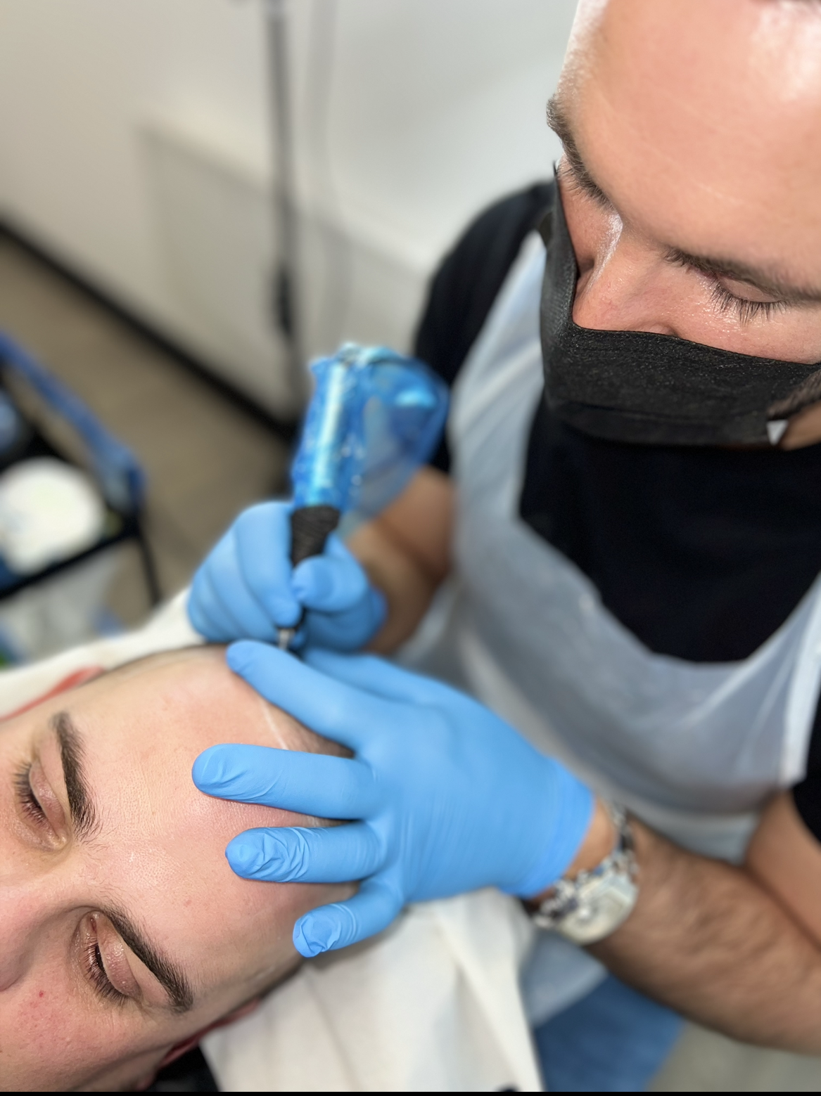 Scalp Micropigmentation being performed on a male model.