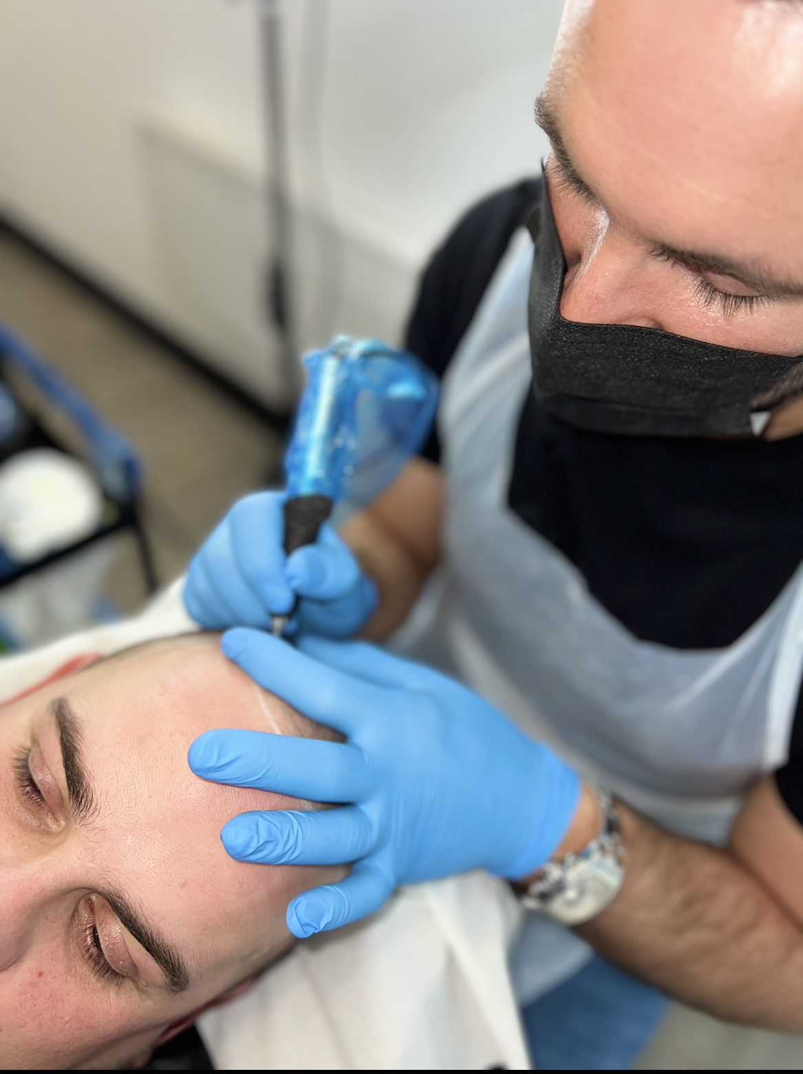 Scalp Micropigmentation