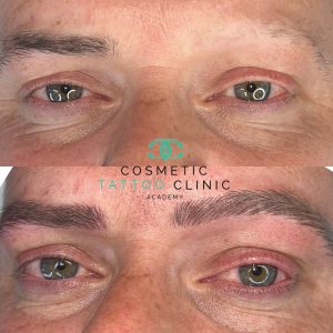 Male Microblading - before & after images.