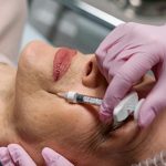 Mature woman having regenerative treatment for wrinkles.