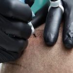 Scalp Tattoo